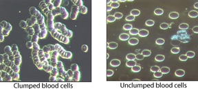 clumped-unclumped-cells